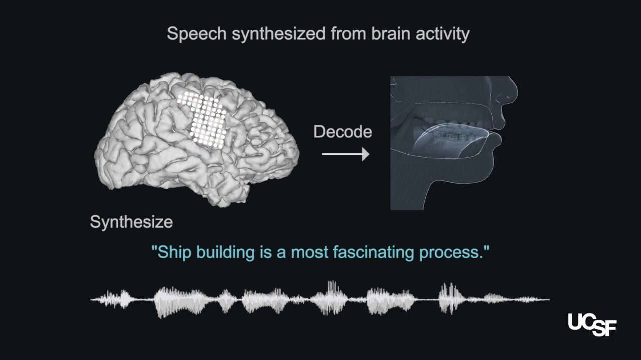 Искусственный интеллект превращает сигналы мозга в человеческую речь — послушайте сами. Фото.