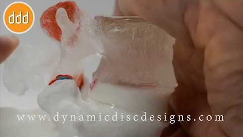 Dynamic Herniation - Protrusion and Extrusion