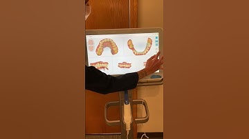Alpine Creek Dental Itero scanner