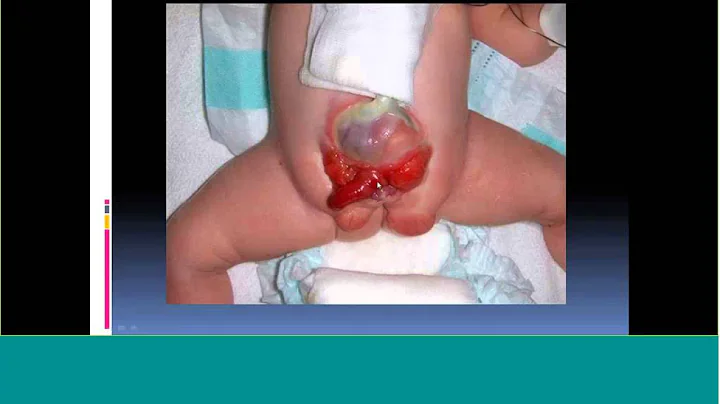 Topics in Fetal Medicine - Hans G. Pohl, M.D.