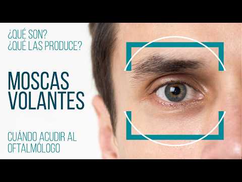 ¿Ves moscas volantes? Señales para acudir al oftalmólogo