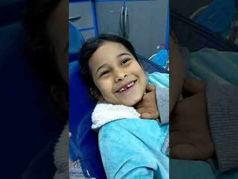 حشو عصب الاطفال دكتور عبدالله سلطان الهنداوي طبيب اسنان    