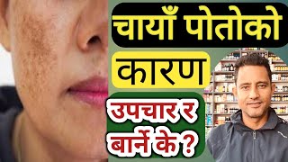 Kalo Poto Chaya Kina Aauxa चायाँ पोतोका ९ कारणहरु । 9 Causes Of Melasma