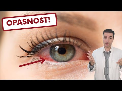 Video: Kateri so znaki ženskega psa v toploti?