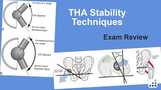 THA Stability Techniques Exam Review - William Griffin, MD