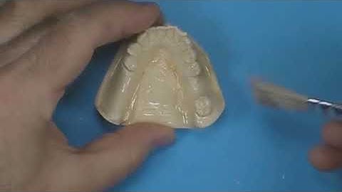 Technique: Surgical Guide