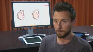 3D tool predicts result of nose job more accurately screenshot 1