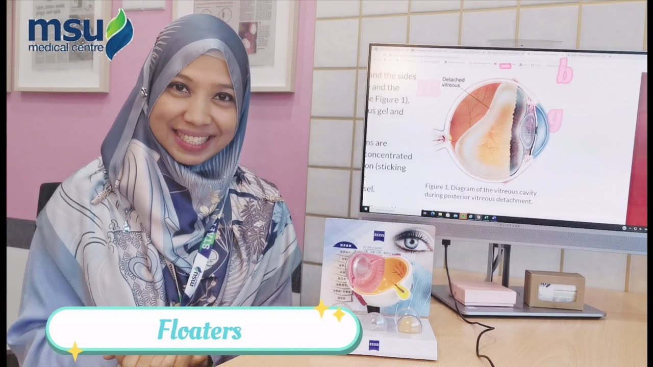 Eye Floaters Itu Apa Eye Floaters Itu Apa
