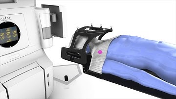 How does stereotactic radiosurgery differ from external beam radiotherapy?interview Dr Andrew See
