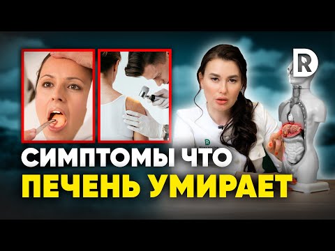 Видео: Как проверить функцию печени: 13 шагов (с изображениями)