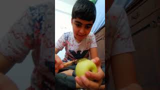 Neşter Ne Kadar Keskin