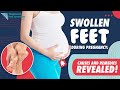 Swollen Feet During Pregnancy: Causes and Remedies Revealed!