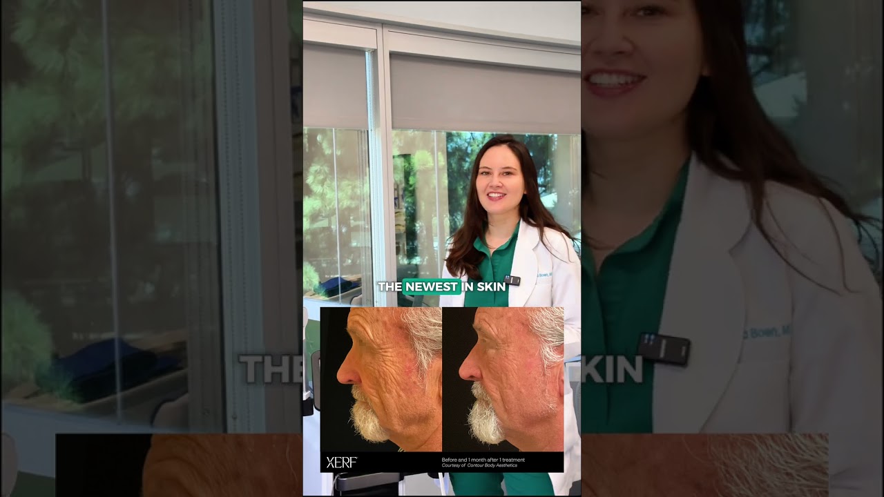 Banner for 💎 Hear more about our newest device from Dr. Boen!! #XERF #SkinTightening #NonSurgical