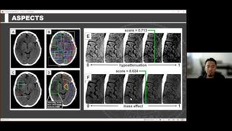 AI4C Lecture Series: Deep Learning in Radiology - Emerging Trends and New Research