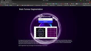 Brain Tumor Segmentation Web App. 👨‍⚕️ screenshot 4