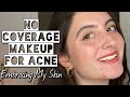 NO COVERAGE Makeup For Acne | Embracing My Skin w/ this Summer Makeup Routine to Enhance Features