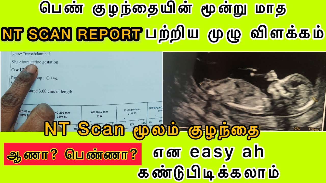 My First Trimester NT Scan Report In Tamil nt Scan In 3 Months Pregnant My First Trimester NT Scan Report In Tamil nt Scan In 3 Months Pregnant