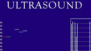 Gravis Ultrasound MIDI Demo 3/14 - "Hide 'n' Seek"