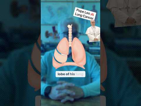Pope Leo Has Cancer - let’s talk about it: #doctor #popeleoxiv #breakingnews