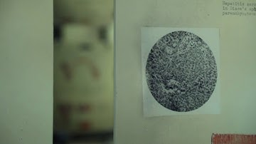 GLOBALink | Uncovering link between U.S. biological lab and Japan