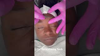 My first derma plane appointment was amazing! Have you ever had one? #youtubeblack #short #shorts
