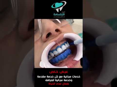 اضواء الابتسامة لطب زراعة وتقويم الاسنان