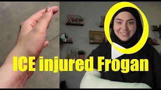 Ice Injured Frogan Hand Ethan Klein Vs Frogan Lawsuit Explained