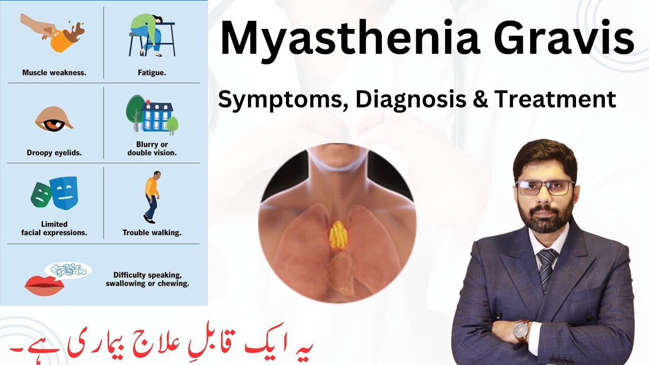 Myasthenia Gravis | Symptoms, Causes, Diagnosis, Surgical Solutions in Urdu/Hindi | Dr. Ahmad Ali