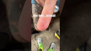 Deer ticks…crazy small #appalachiantrail #hiking #lymediseaseawareness