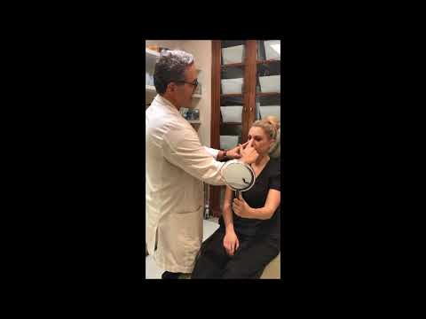 Video thumbnail: How to do your compression exercises after rhinoplasty — DR. JOSHUA ZIMM