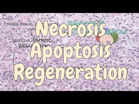 Necrosis, apoptosis and regeneration - liver pathology