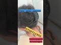 Сулук менен дарылоо.Шейногрудной остеохондроз.Бишкек 0708711902