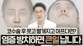 함몰유두수술, 유두감각이 없어진다?! ㅣ타미Tvㅣ - Youtube