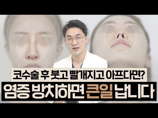 코수술 후 염증 증상 "괜찮겠지" 하고 방치했다간..큰일 납니다.｜염증의 원인, 증상, 해결방법은?