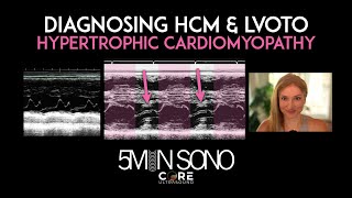 Hypertrophic Cardiomyopathy (HCM) + Left Ventricular Outflow Tract Obstruction (LVOTO) Explained!