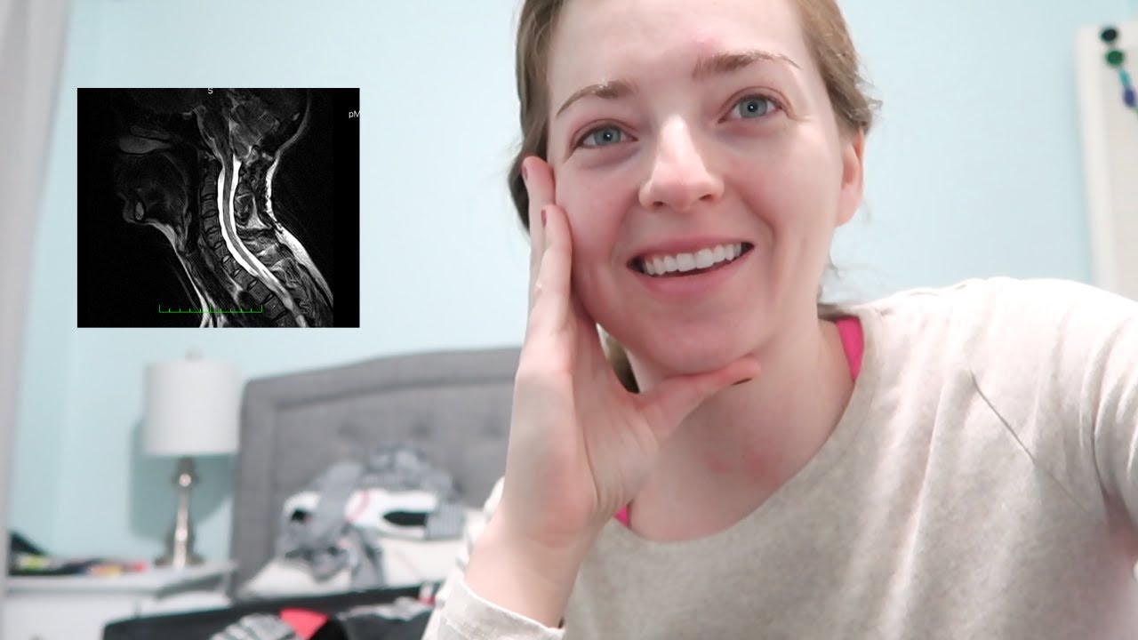 My Neck Instability Improved on Imaging! (After PRP Injections)
