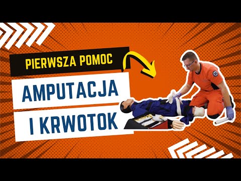 Wideo: Jakie są rodzaje amputacji?