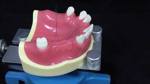 Hidden x suture #11 - Back to the suture