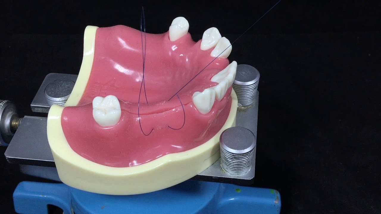 Hidden x suture 11 Back to the suture YouTube