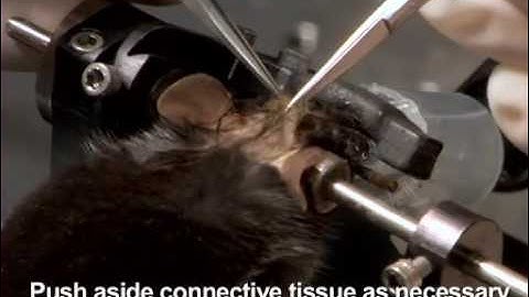 Fibre optic implantation