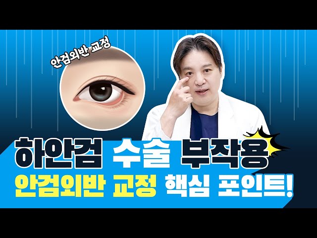 하안검 수술 부작용, 뒤집어진 눈꺼풀 안검외반 교정을 위한 핵심포인트! 안검외반 원인과 해결 방법 [JW정원성형외과]