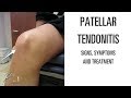 Patellar tendonitis: Signs, symptoms and remedies for this difficult knee problem