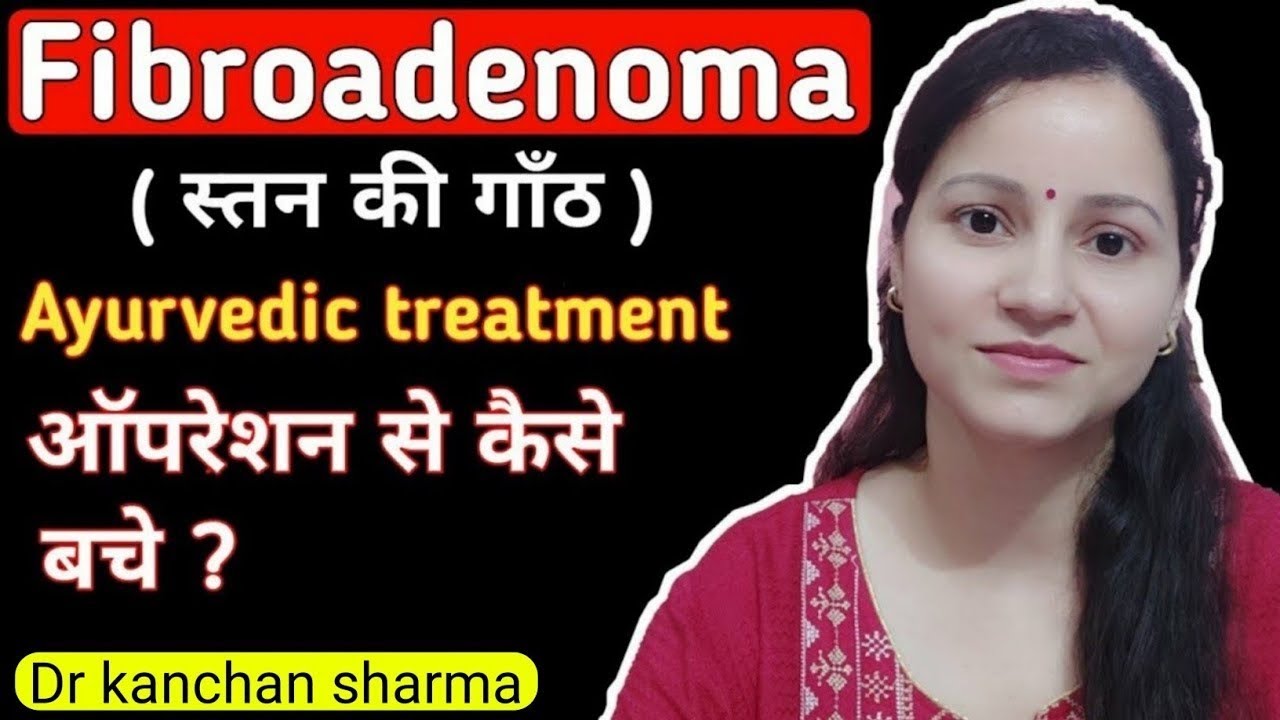 Fibroadenoma Cure Naturally Treatment At Home  How To Cure Breast Lump  Naturally At Home 