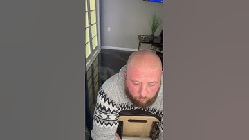 Beautiful Scalp Micropigmentation result for light skin and light hair combination - SCALPS