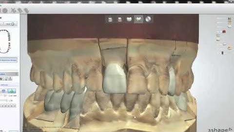 3Shape D900 Color Scanner by Argen Canada