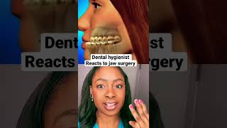 Dental hygienist reacts to jaw surgery #shorts #jawsurgery #dentalhygienist