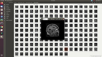 Implementation on Brain Hippocampus Segmentation Using Improved UNET | Python|