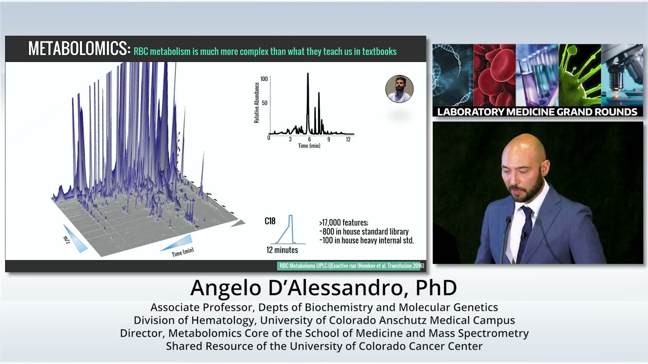 High-Throughput Omics and Red Blood Cell Storage lesion: Towards Personalized Transfusion Medicine