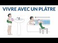 Comment vivre avec un pltre 