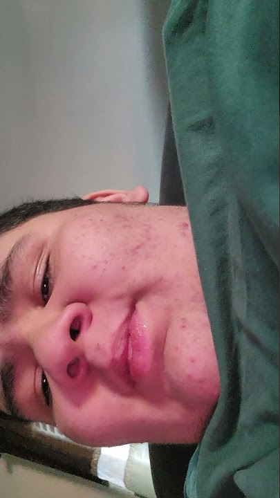 sneeze sound effect